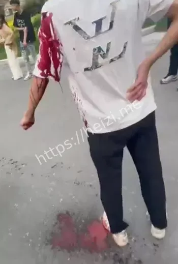当街砍人
