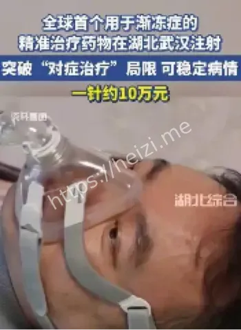 渐冻症
