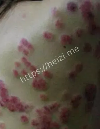 健康教育