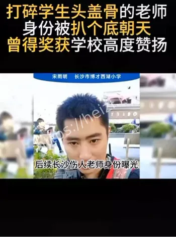 监控缺失