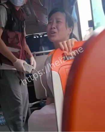 颅骨骨折