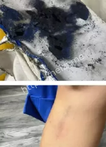 售后服务