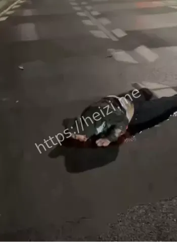 腰椎断裂