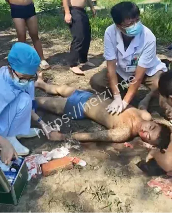 七窍流血无力回天