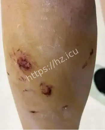 女生被流浪狗围咬