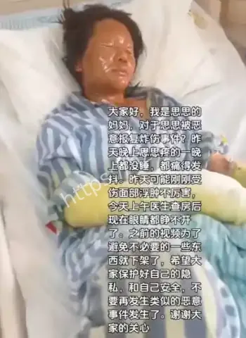思思被炸弹炸成重伤