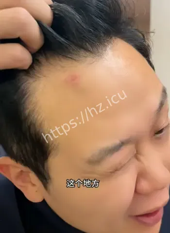 球迷遭飞车党枪顶脑门